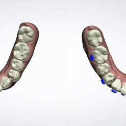 Model Before/After