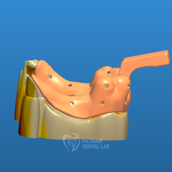 - - Vietnam Dental Lab