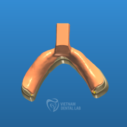 Denture Impression Trays