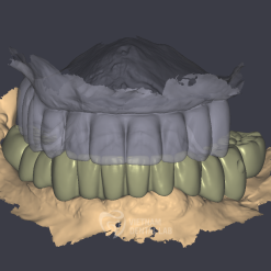 - - Vietnam Dental Lab