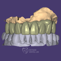 - - Vietnam Dental Lab