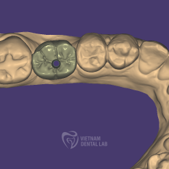 - - Vietnam Dental Lab