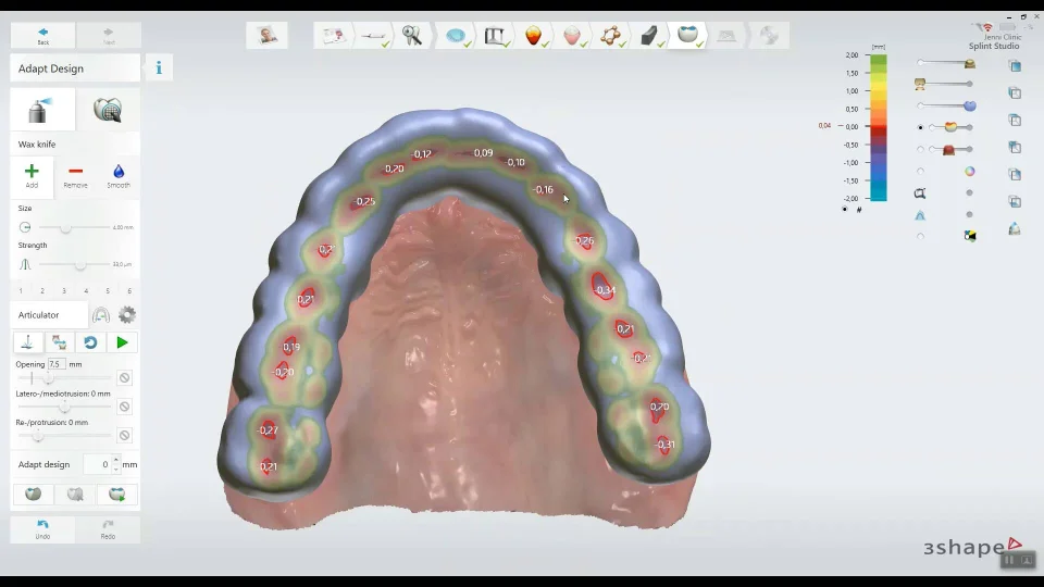 revolutionizing dental design software transforming vietnam s dental laboratories 676a89fb38e9d - Revolutionizing Dental Design Software - Transforming Vietnam's Dental Laboratories - Vietnam Dental Lab