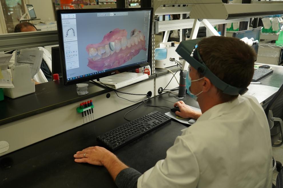 A 3D-printed dental aligner being prepared.