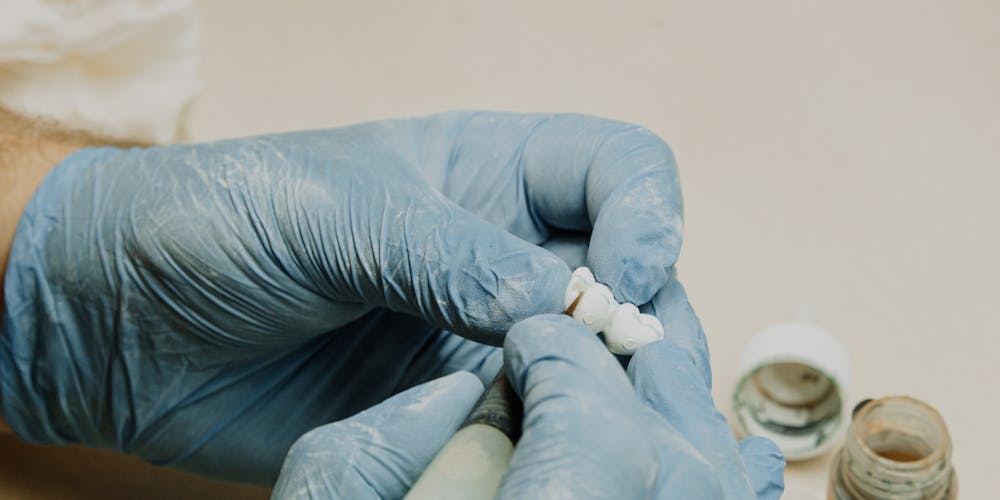 the benefits of partnering with vietnamese dental labs for outsourcing services 67b6117b195bd - The Benefits of Partnering with Vietnamese Dental Labs for Outsourcing Services - Vietnam Dental Lab