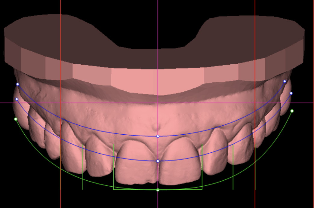 view 67b4b306225ce - Vietnam Dental Lab – Your Trusted Partner in Digital Dental Solutions - Vietnam Dental Lab
