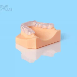 3D-printed soft splints