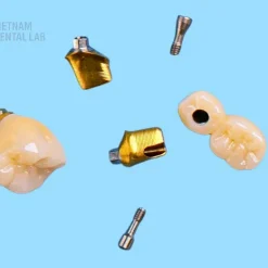 Cement- and screw-retained implants