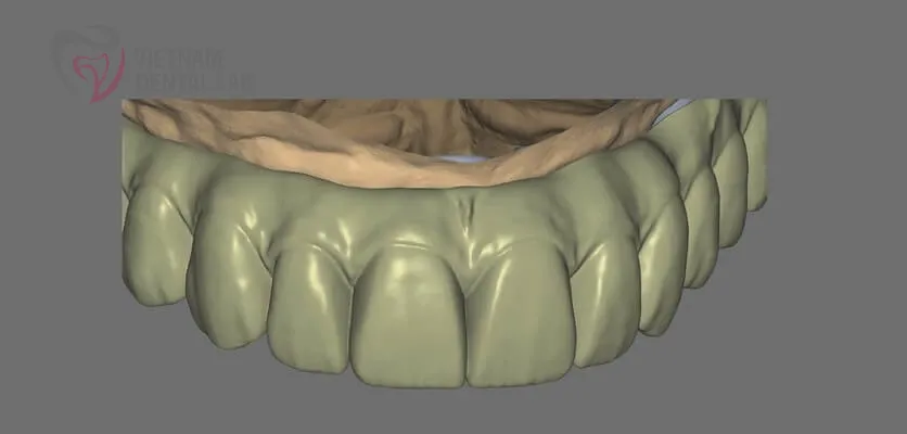 all2 full - Deliver Your CAD/CAM Cases On Time - Vietnam Dental Lab