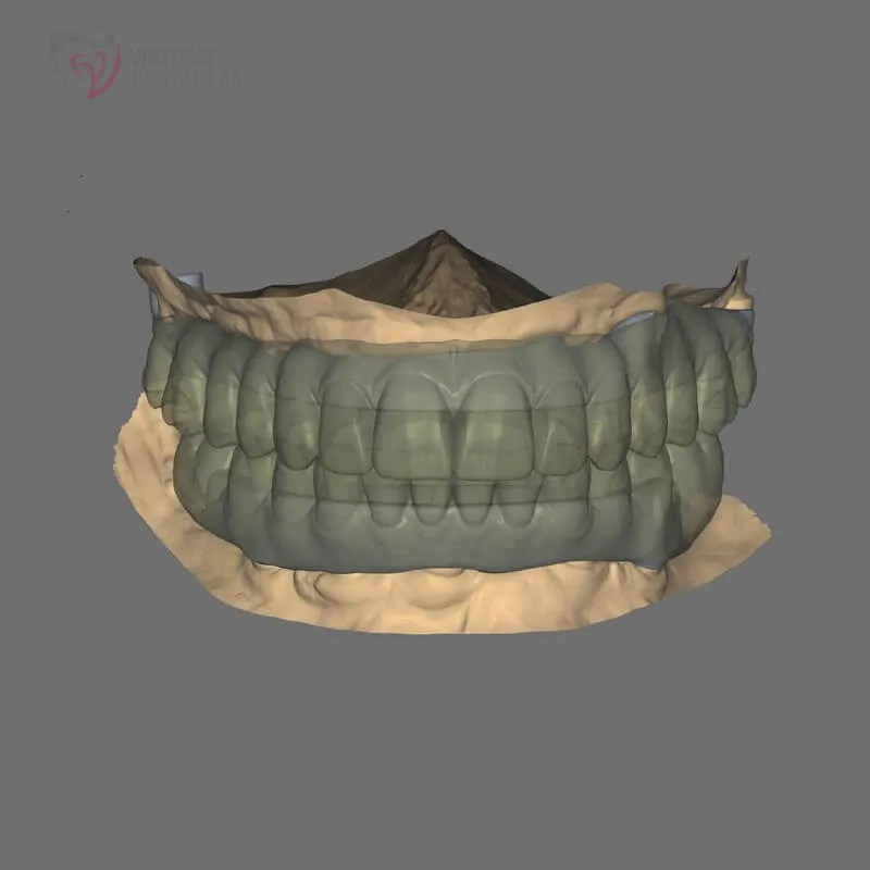 all3 full - Deliver Your CAD/CAM Cases On Time - Vietnam Dental Lab