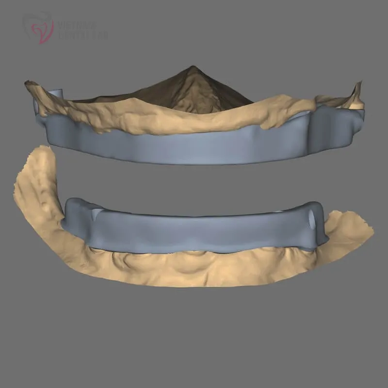 all4 full - Deliver Your CAD/CAM Cases On Time - Vietnam Dental Lab