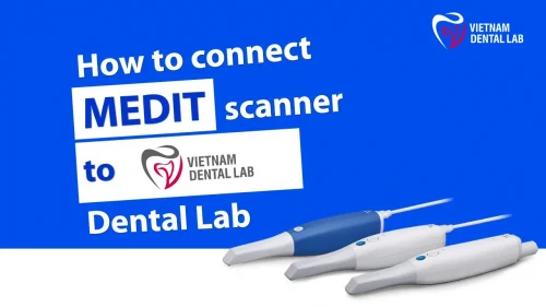 connect medit scanner to vietnam dental lab - Guide to Connecting with Vietnam Dental Lab on Medit Link - Vietnam Dental Lab