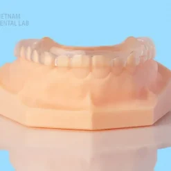 Hard-soft splints