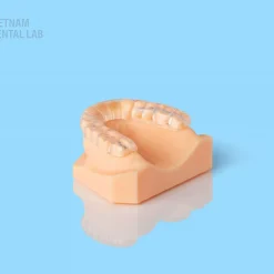 Milled hard splints