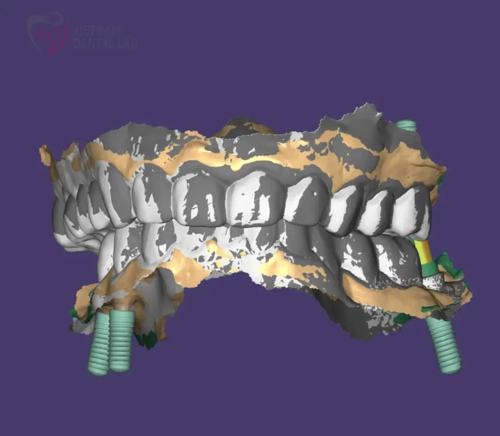 screenshot 1 - Deliver Your CAD/CAM Cases On Time - Vietnam Dental Lab