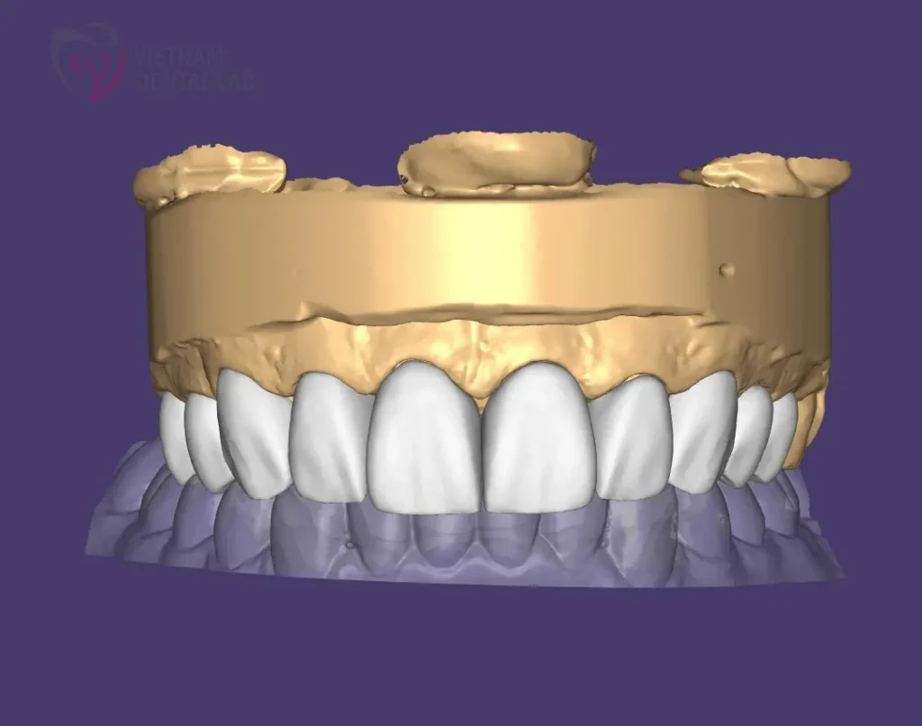sqr yq2 1 - Deliver Your CAD/CAM Cases On Time - Vietnam Dental Lab