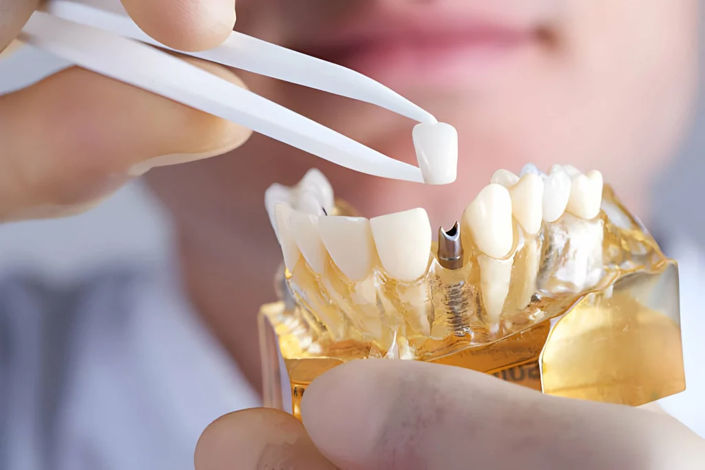 - - Vietnam Dental Lab