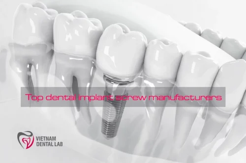 Top dental implant screw manufacturers - Top dental implant screw manufacturers: A guide to the leading brands - Vietnam Dental Lab